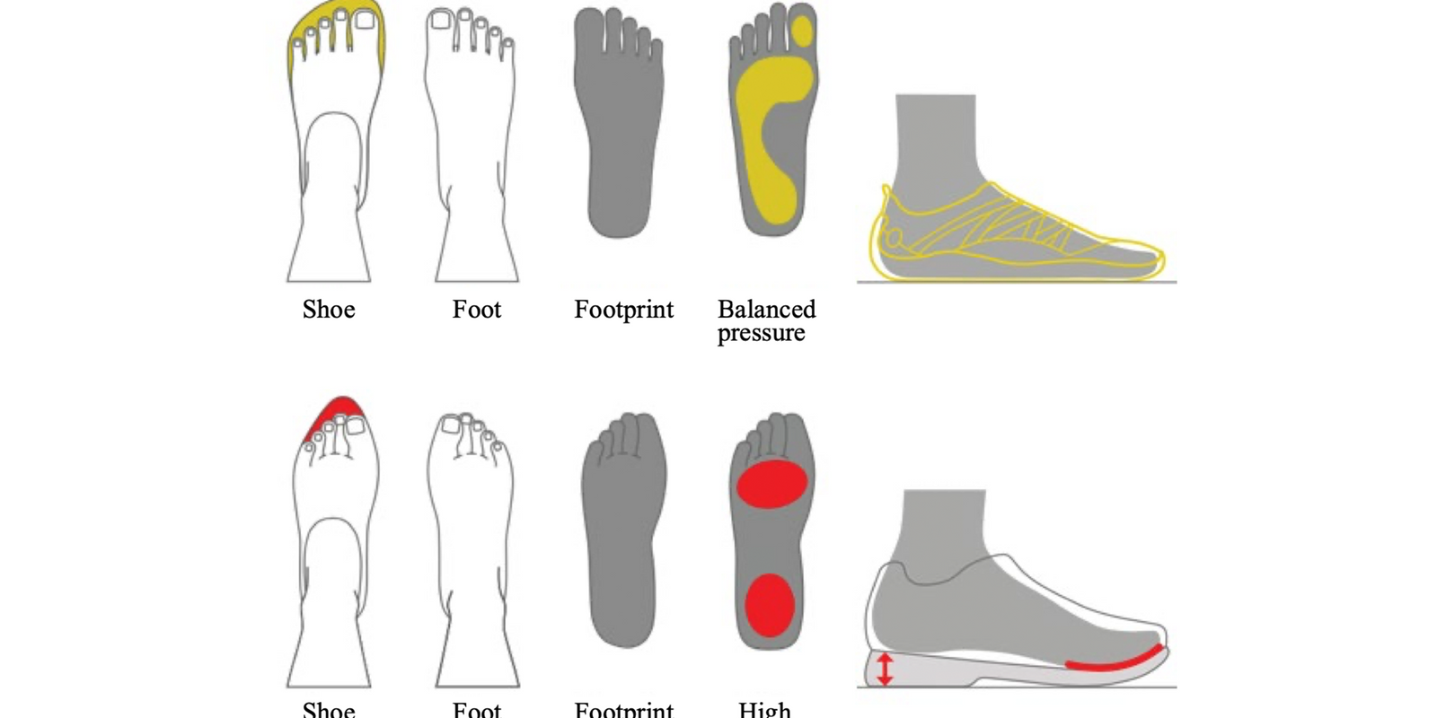 Füße und Schuhe: Anwendung von biologischem Design und Fehlanpassung