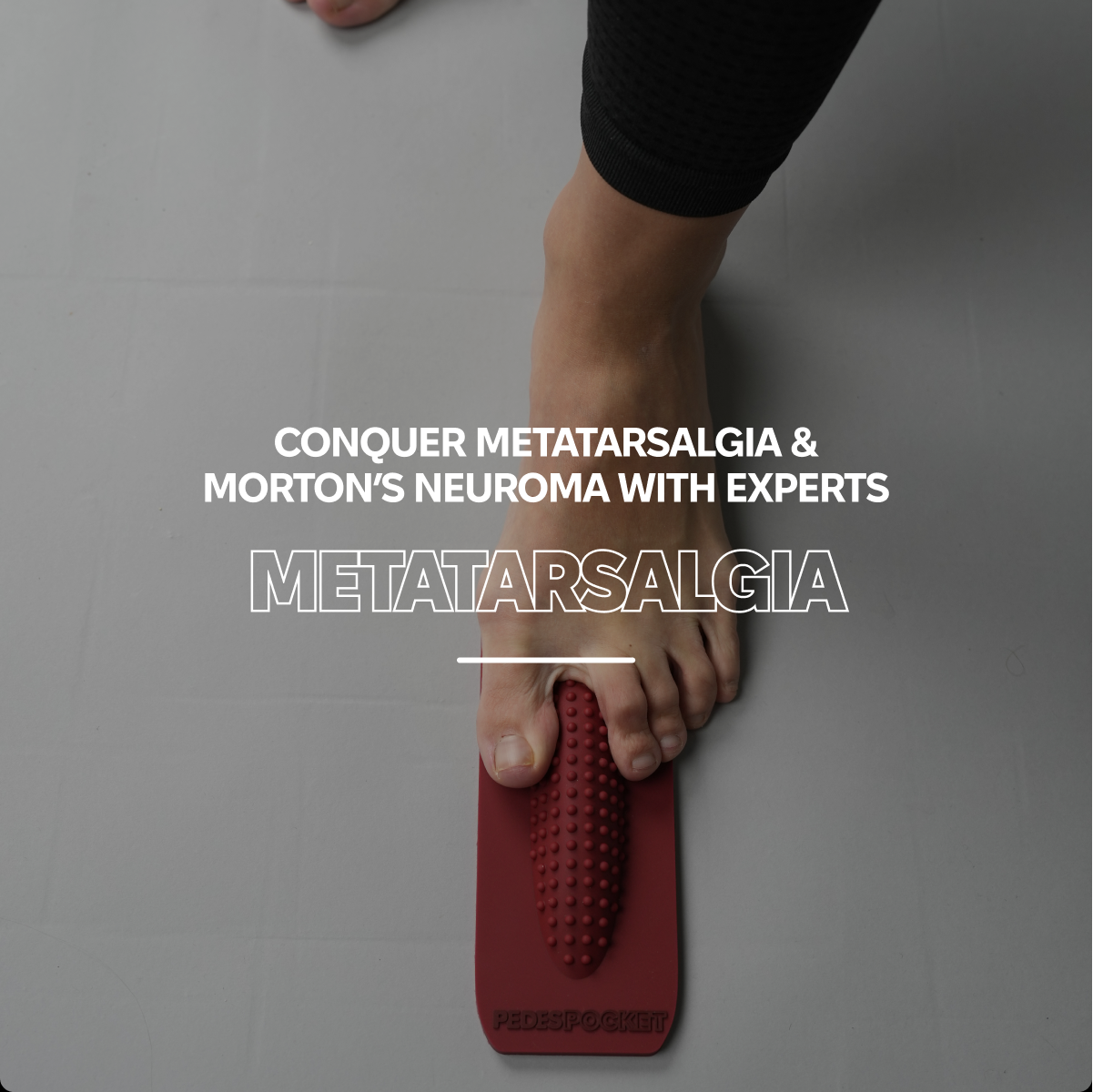 Metatarsalgia workshop