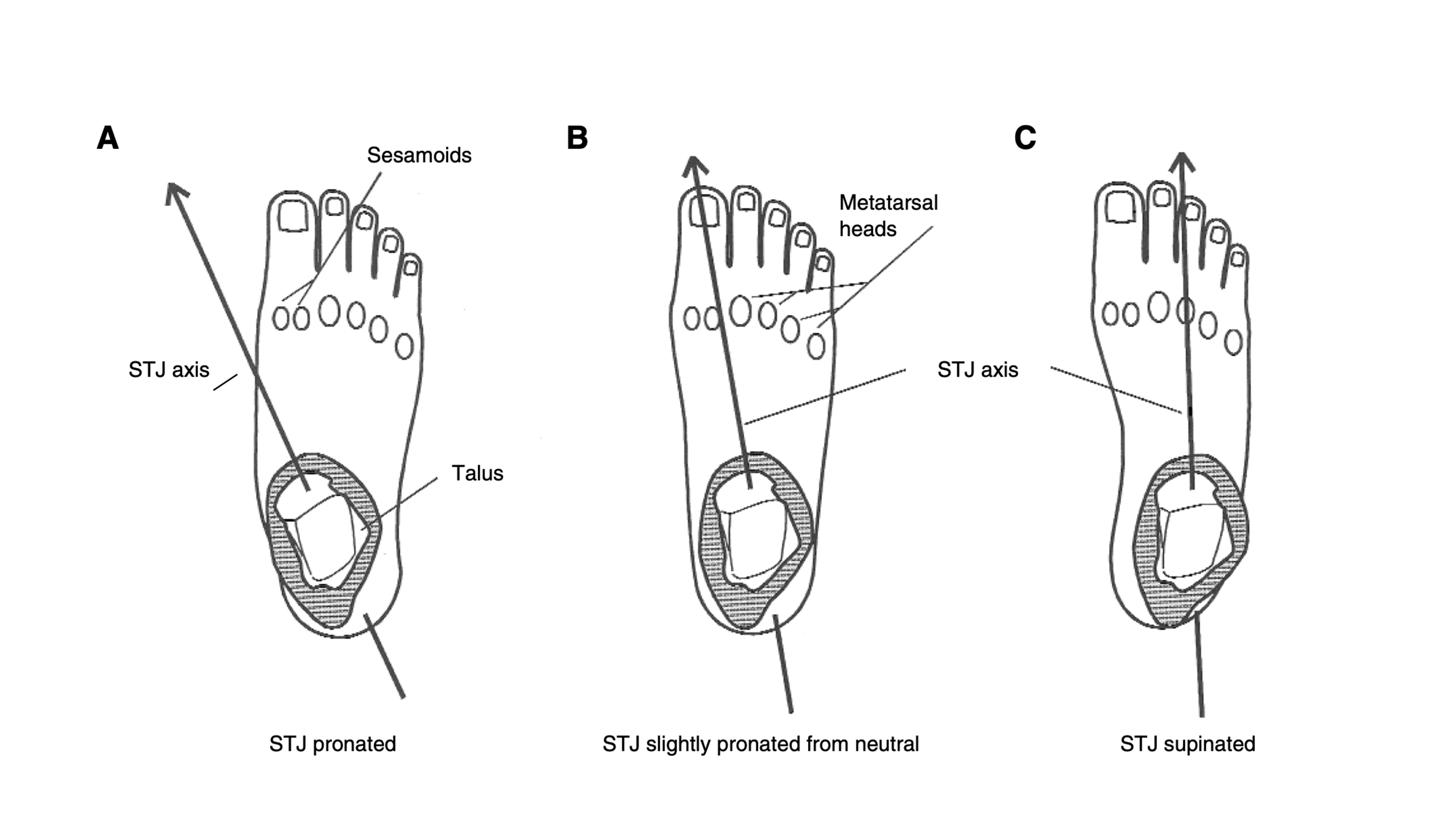 Subtalar Joint Axis Location and Rotational