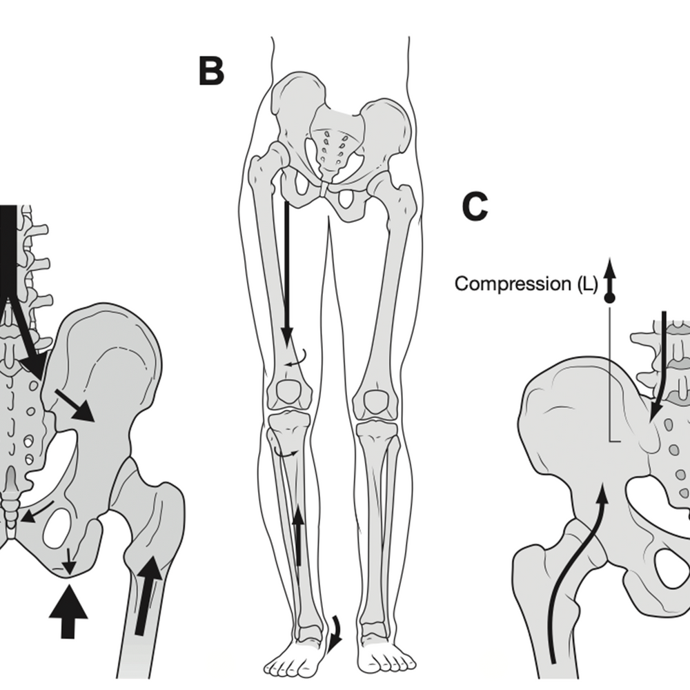 Pf Malalignment Malalignment Syndrome in Runners - Wolf Schamberger – My Foot Function