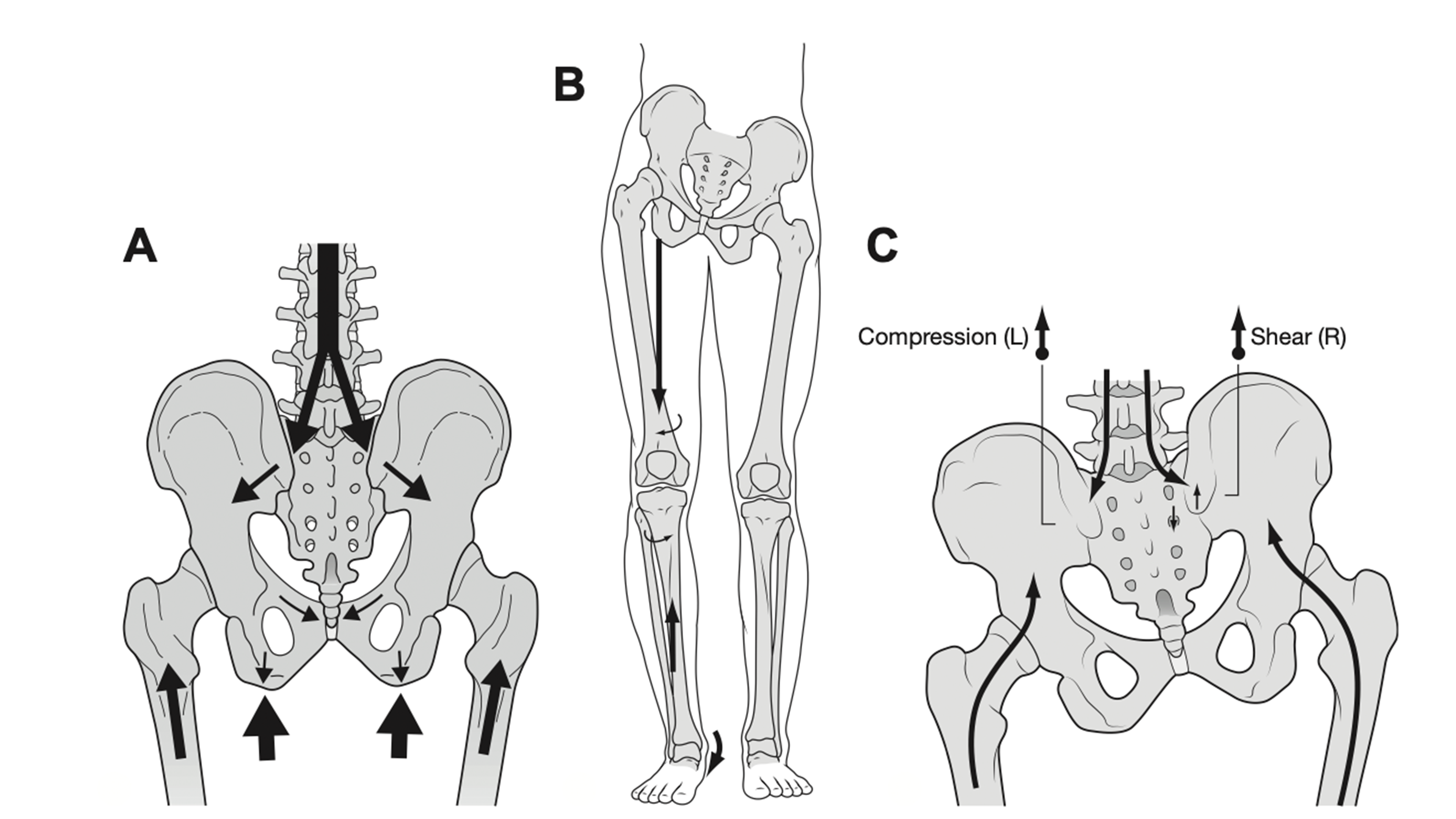 Pf Malalignment Malalignment Syndrome in Runners - Wolf Schamberger – My Foot Function