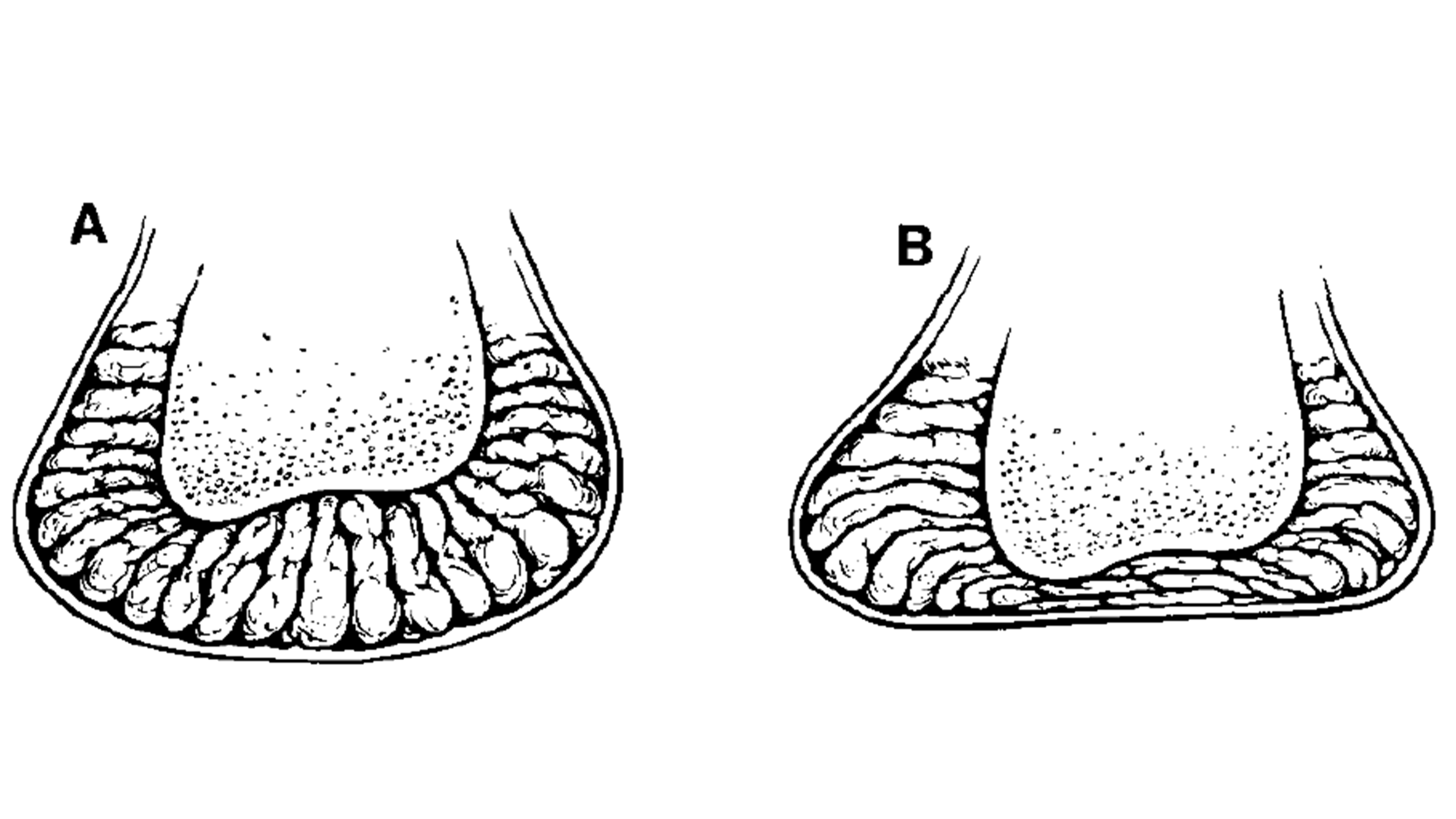 Investigations into the Fat Pads of the Sole of the Foot