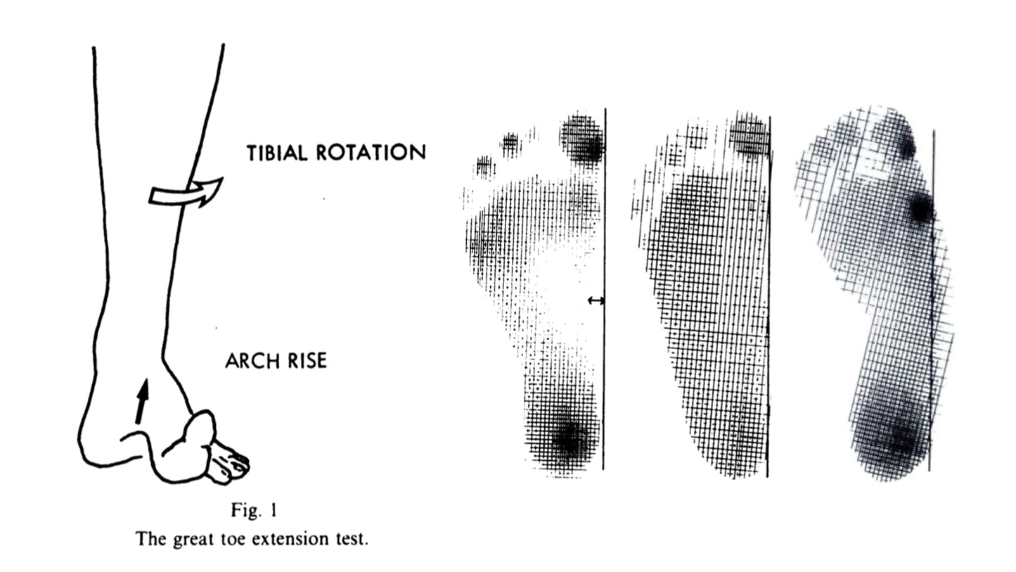 The diagnosis of flat foot in children
