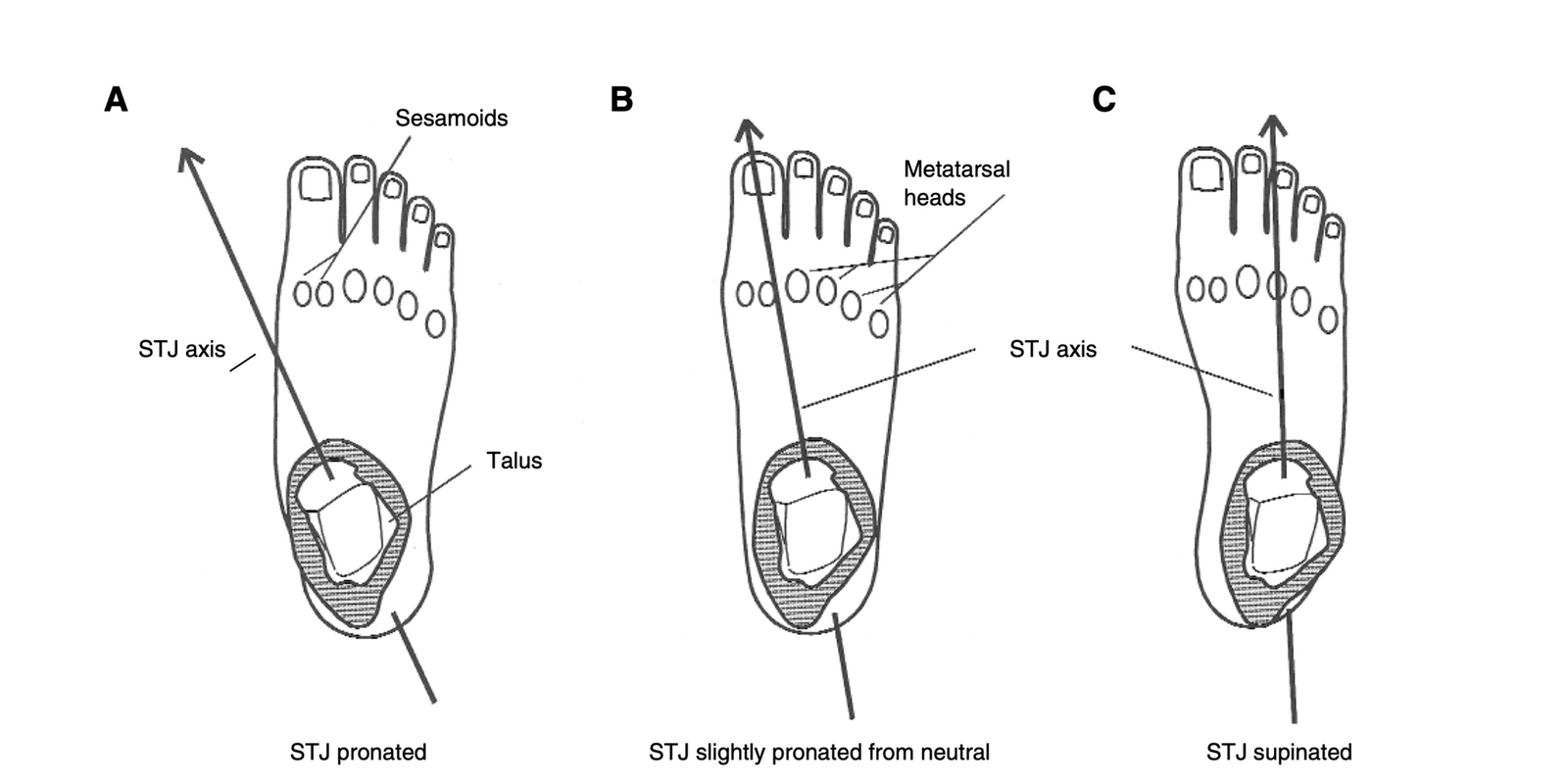 Subtalar Joint Axis Placering och Rotation
