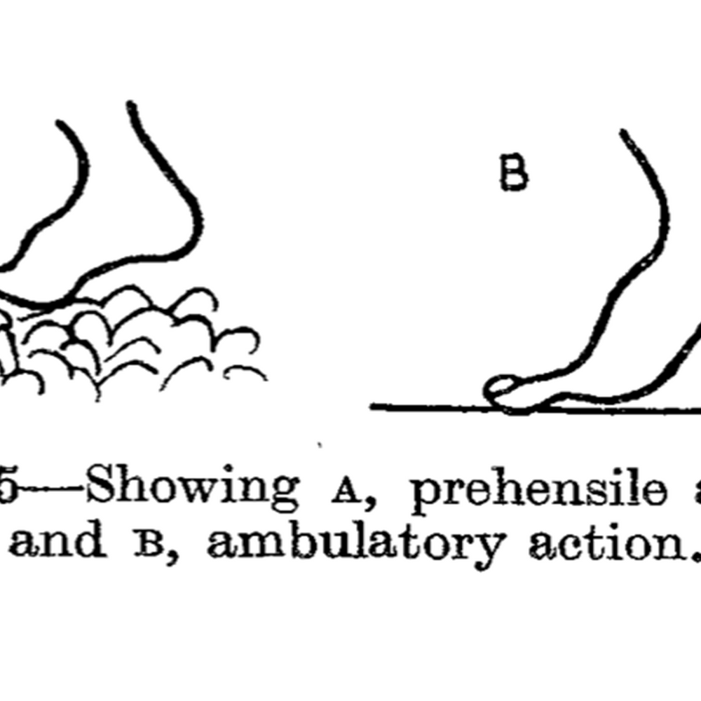 The feet of the industrial worker - E. P. CATHCART, M.D