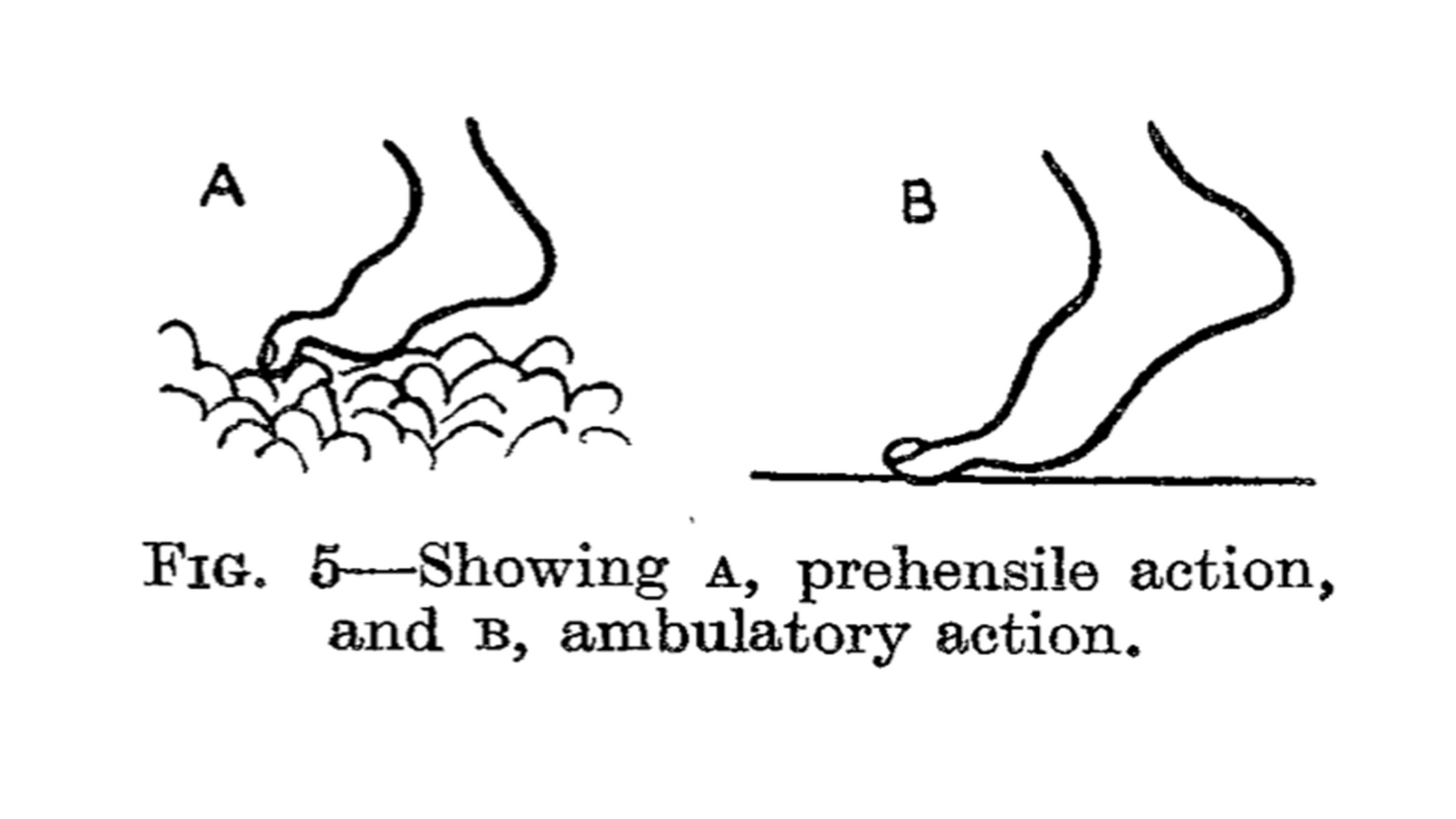 The feet of the industrial worker - E. P. CATHCART, M.D