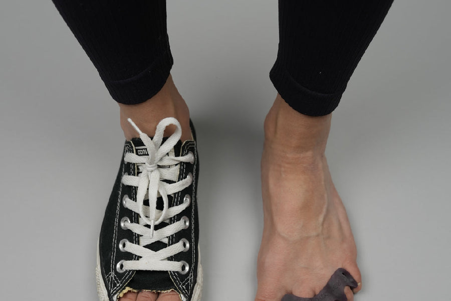 The Truth About Bunion Surgery: 64% Recurrence