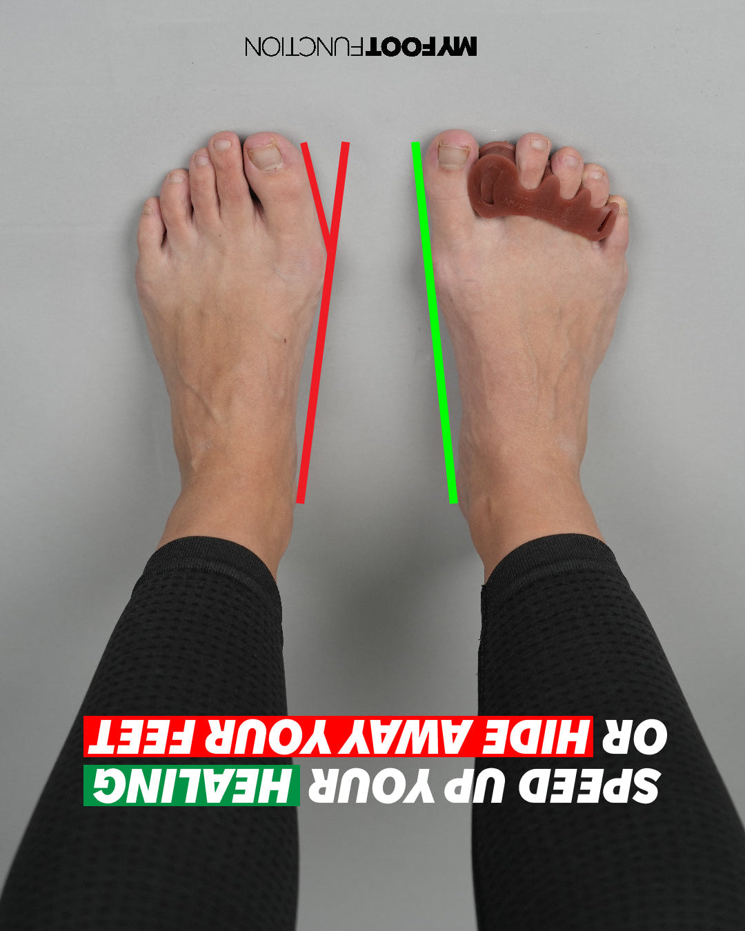 Follow-Up Sessions – My Foot Function