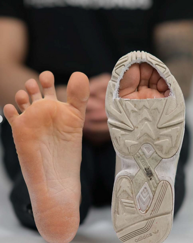 Image showing healthy feet vs a fot in a shoe