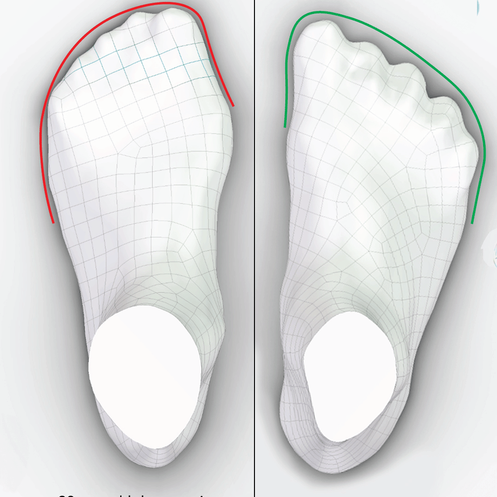 The Shoe Effect – My Foot Function