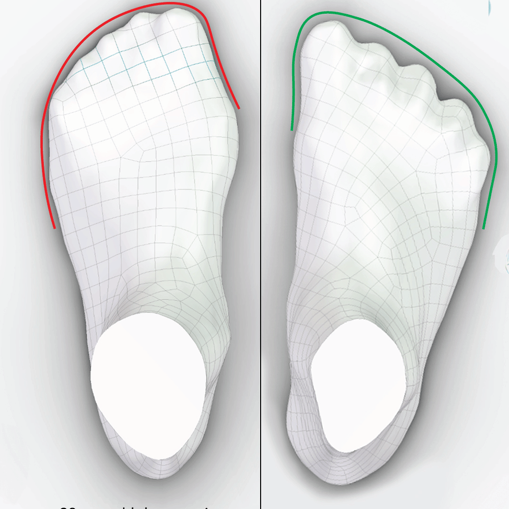 Impacto del calzado en la forma y función del pie: