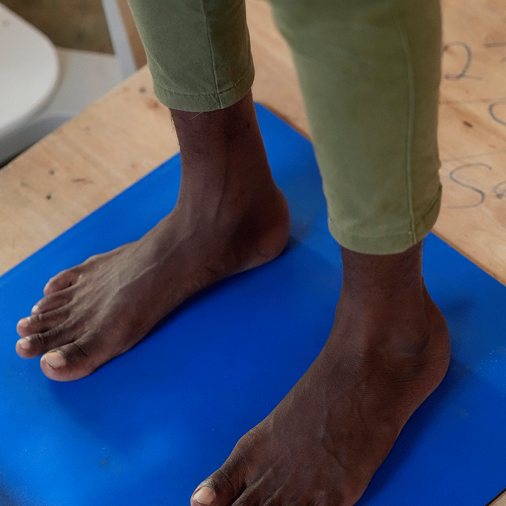 Influencia socioeconómica en la salud del pie:
