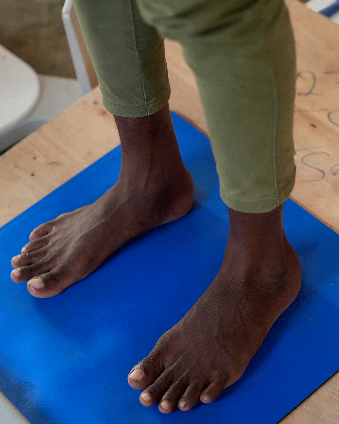 Influencia socioeconómica en la salud del pie: